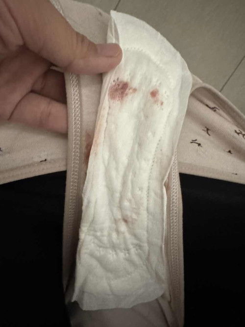 (PHOTO) Help. Im spotting and worried