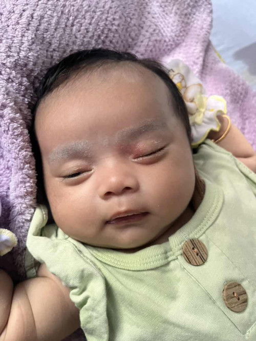 Kelopak mata bayi merah dan sedikit bengkak