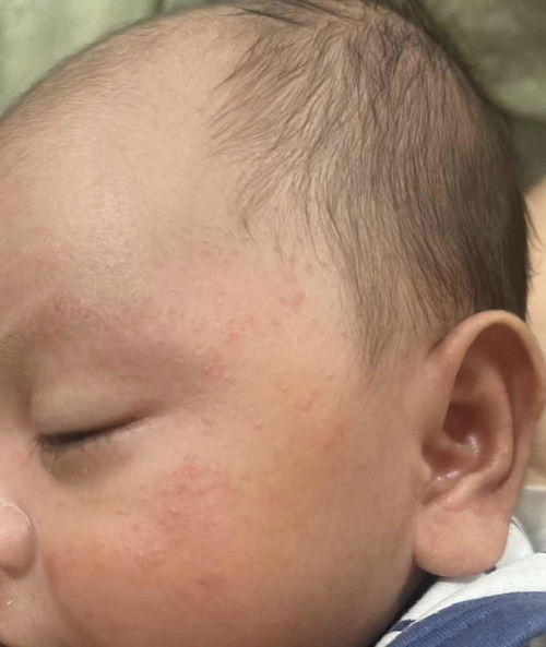 Kulit anak