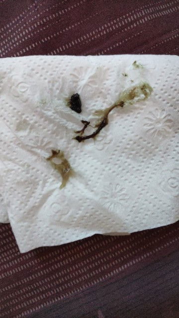 Lendir berwarna coklat