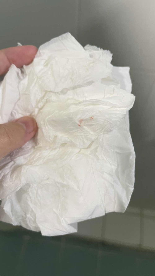 มีเลือดออกแบบนี้ต้องหาหมอมั้ยคะ