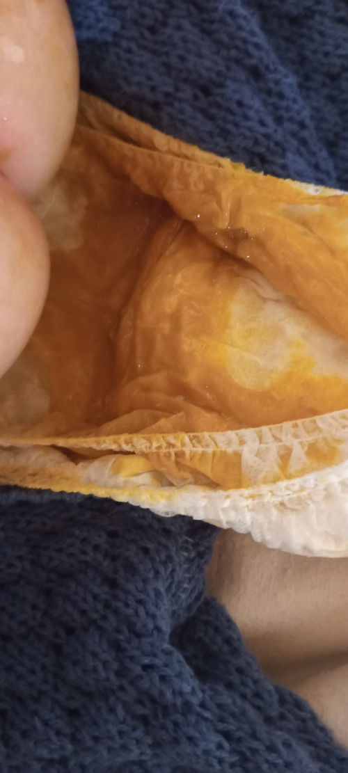 Bayi usia 2 bulan 25 hari