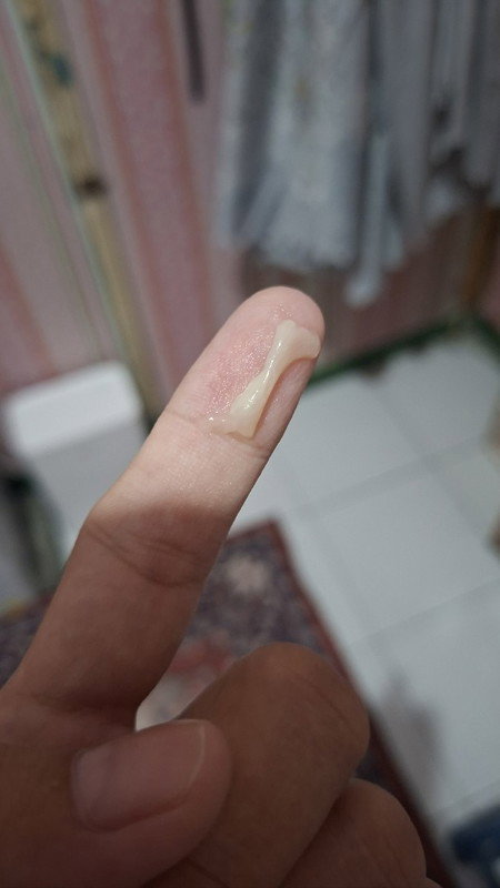 Keluar lendir kental saat hamil 39 minggu lebih 2 hari