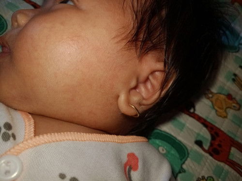 Cara hilangkan beruntusan gimana Bun mohon bantuannya masih new mom