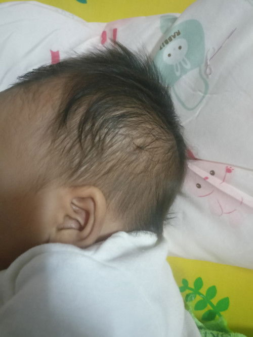 หัวทุยกับหัวแบน