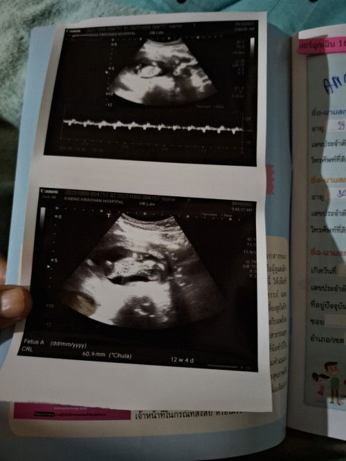 12 w 2 d