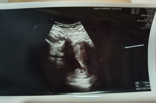 ตามหาทีมแม่ๆผ่าตัดแก้หมันคร้า