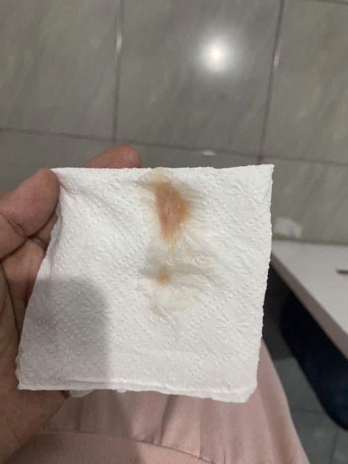 keluar flek di 38 minggu