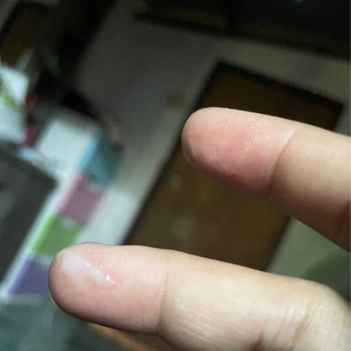 36+6สัปดาห์ แบบนี้ตกขาวใช่ไหมค่ะมีอาการหน่วงๆท้อง