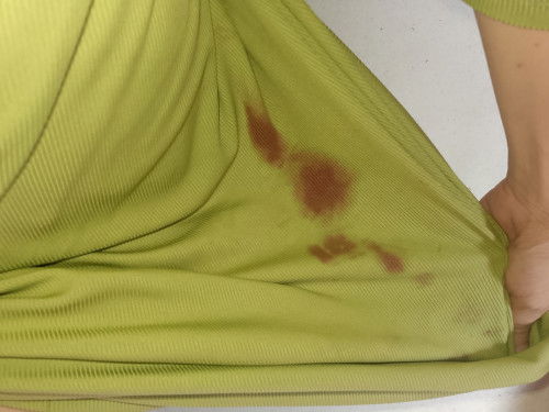 I have heavy bleeding like napupuno tlga Ang napkin q but I go to er close cervix Naman...