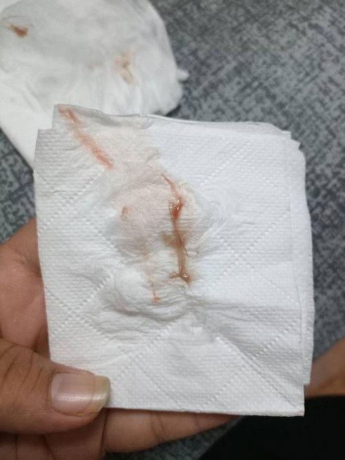 สอบถามค่ะ พอดีตรวจครรภขึ้น 2 ขีดแบบจางๆแทบจะมองไม่เห็น พอเวลาผ่านมาสองวันมีอาการปวดหน่วงท้องน้อยแล้ว