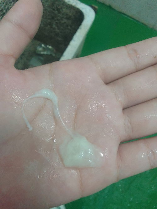 มีมูกขาวออก