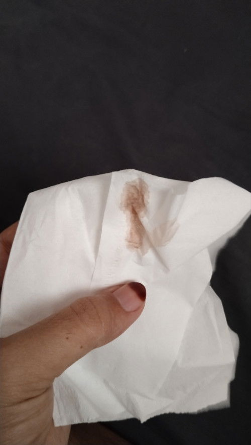 Keluar cairan seperti ini gimana ya bun? Usia kandungan 7minggu🥺