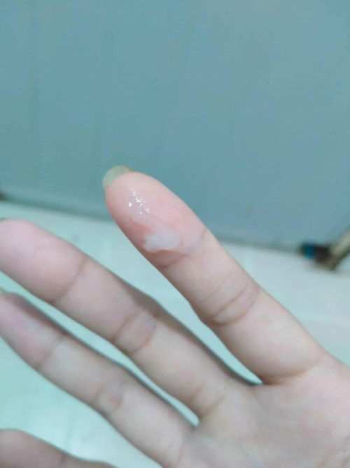 ท้องได้15W+2 คือมูกหรือตกขาวหรอคะแม่ๆ ท้องแรกท้องสองไม่เคยเห็นพึ่งมาเห็นตอนท้องสาม