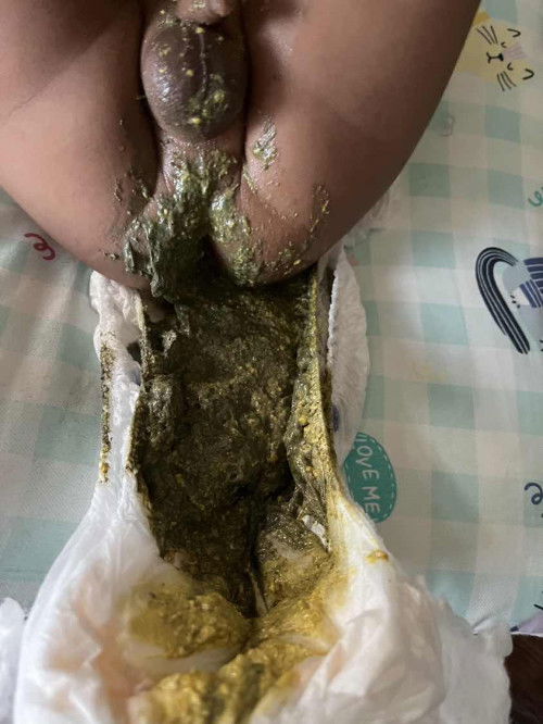 Normal bab bayi 7 bulan