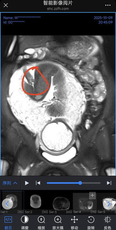 Tolong bun, benarkah ini Testis ?