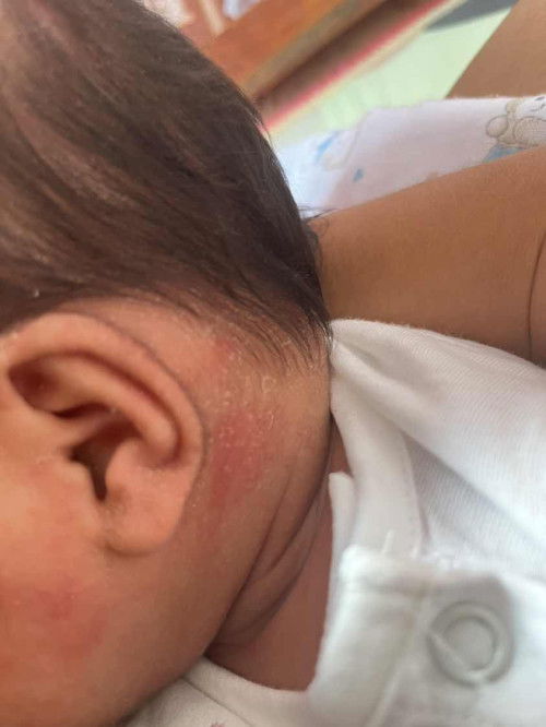 เเเบบนี้คืออะไรคะ ขึ้นเหมือนรังเเค