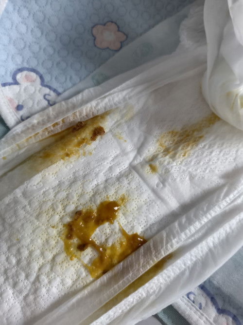 ขอสอบถามค่ะ อึแบบนี้ปกติไหมคะ