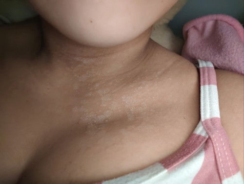 almost 2 months Postpartum