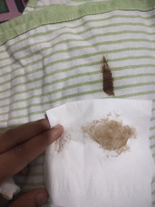 Keluar flek coklat hamil 7 bulan