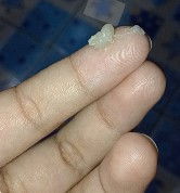 หมูกหรือตกขาว