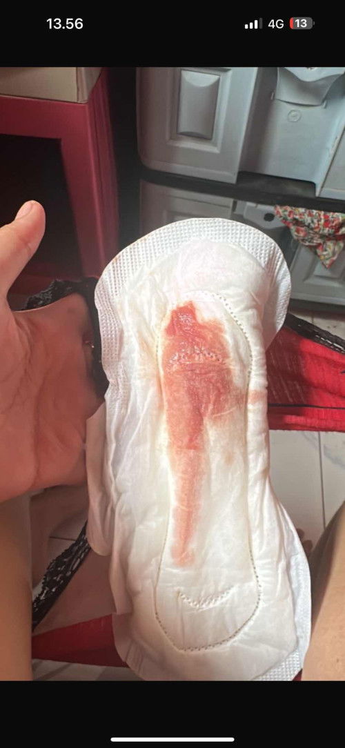 Keluar flek coklat dan merah