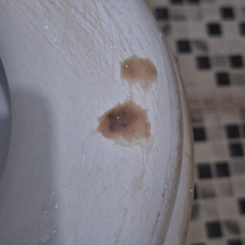 Apa ini foto flek tanda mw lahiran?