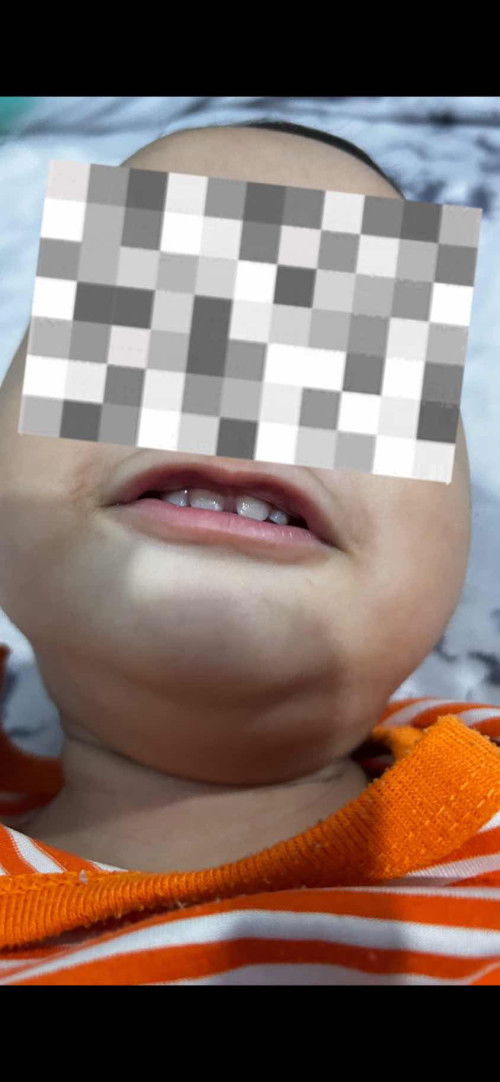 Gigi atas baby memang jarang ke ?