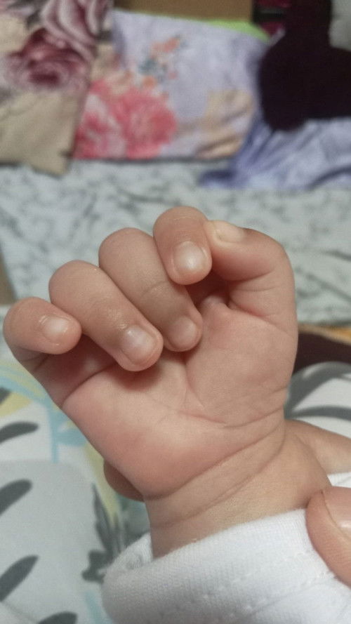 Hello mommies! Newbie po ako. Normal ba sa 1 month baby ang ganitong nails?