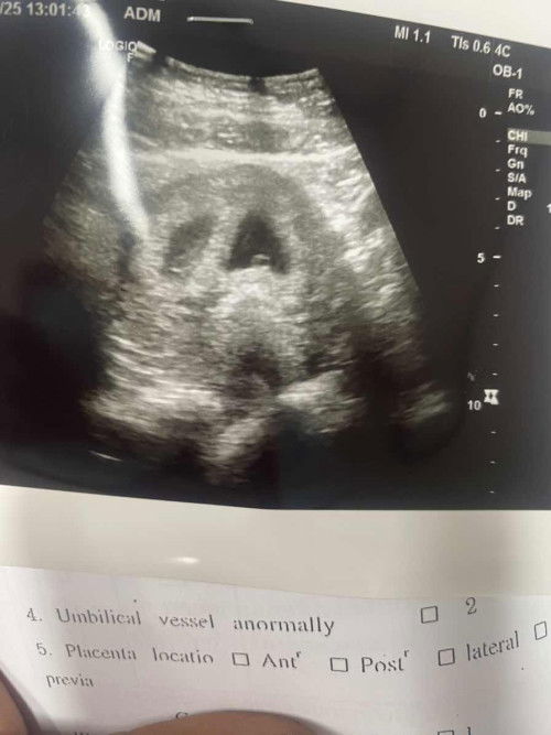 อยากให้แม่ๆช่วยดูหน่อยค่ะใช่น้องแฝดมั้ยคะ