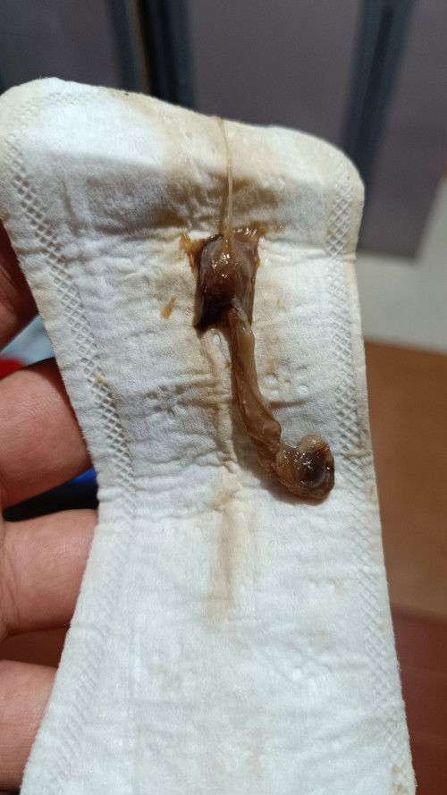 Mucus Plug