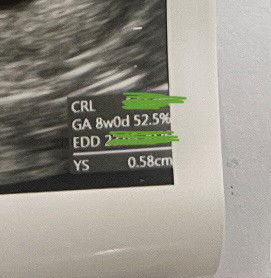 GA 8w0d 52,5% maksudnya gmn yaa moms