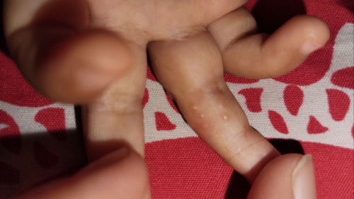 Bintik-bintik berair