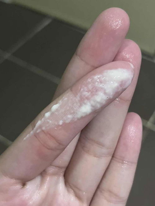 ตกขาวแบบนี้อันตรายมั้ยคะ ท้องแรกกลัวไปหมดทุกอย่างเลยค่ะ กลัวติดเชื้อ