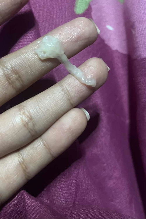 แบบนี้เรียกว่าอะไร ปกติไหมคะ