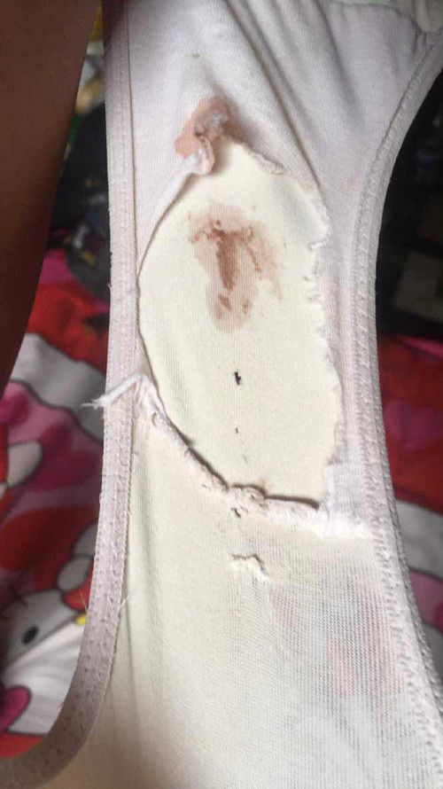 Normal lang ba sa 38 weeks yung after Eh IE ay may lalabas na discharge na kulay brown sa pwerta?