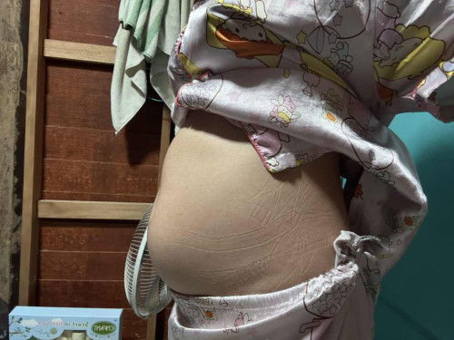 สอบถามแม่ๆค่ะ