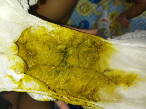 Pop Bayi yang berlendir hijau