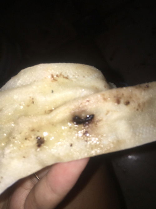 mga momsh? Ask kolang normal lang ba tong lumalabas nato pag nag lalagay ng (EVENING PRIMROSE OIL?