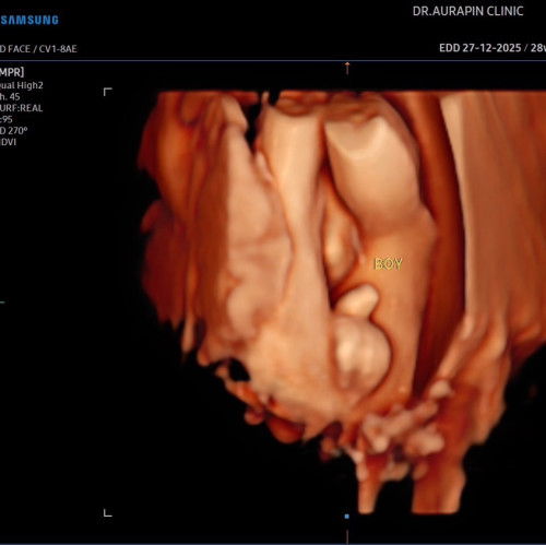 ลูกชายคนแรก