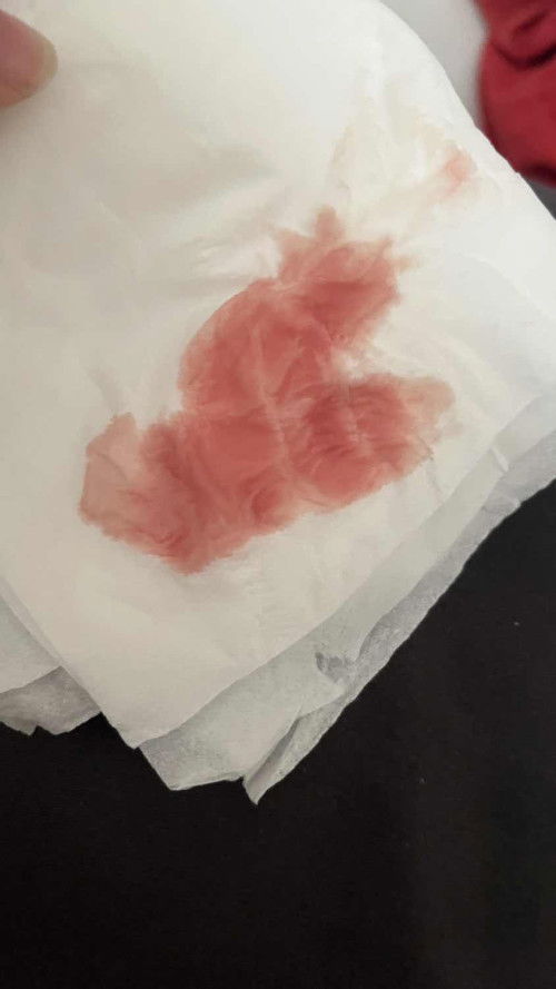 อยากถามแม่ๆว่ามีใครเคยมีประสบการณ์แบบนี้ไหมคะ