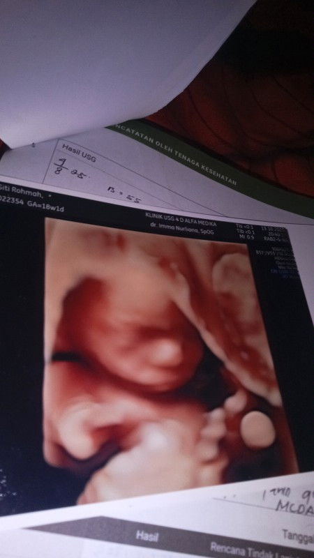 Pengalaman hamil kedua