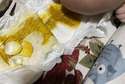 Normal lang po ba ang poop ni baby?