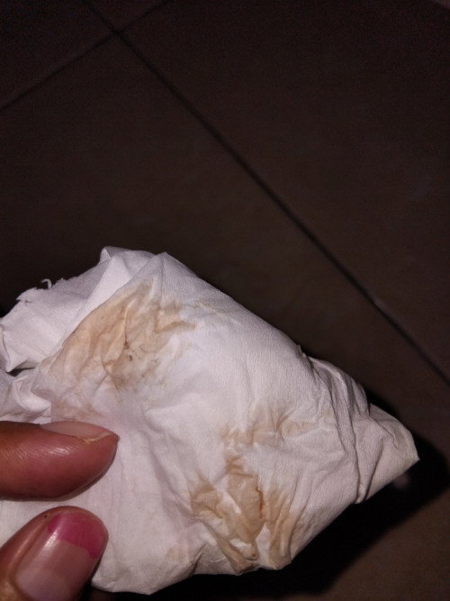 Flek coklat 
Disclaimer fotonya sensitif🙏🏻