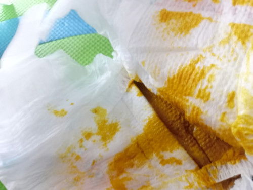 Normal LNG po yan na dumi ng isang 4montha old baby