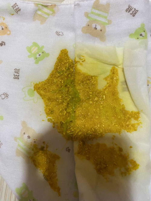 อึสีเขียวอ่อนปนแบบนี้ปกติไหมคะแม่ๆ