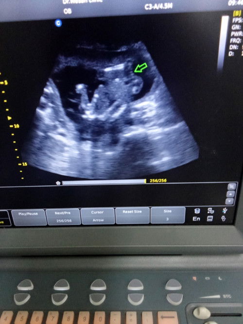 ซาวด์เพศลูก