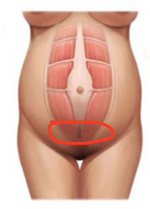 ปวดร้าวไปถึงหลัง