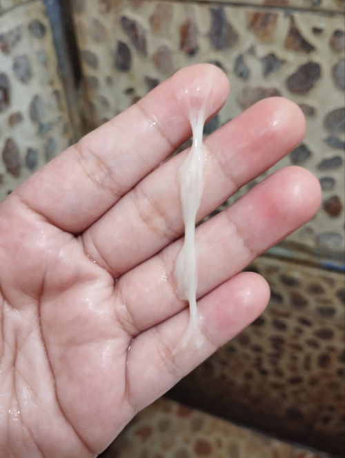 Thick and stretchy discharge everyday