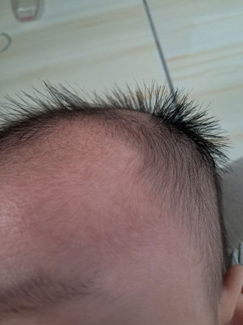 Nyari rekomendasi salep buat brentusan